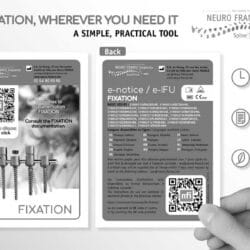 Evolution Implants Chirurgicaux32 Nb